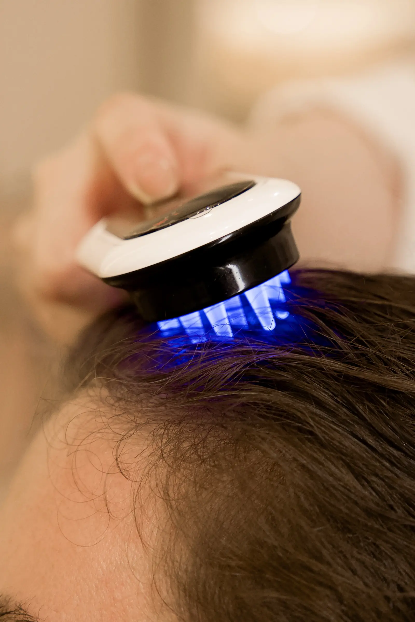 Blue LED light therapy at the scalp